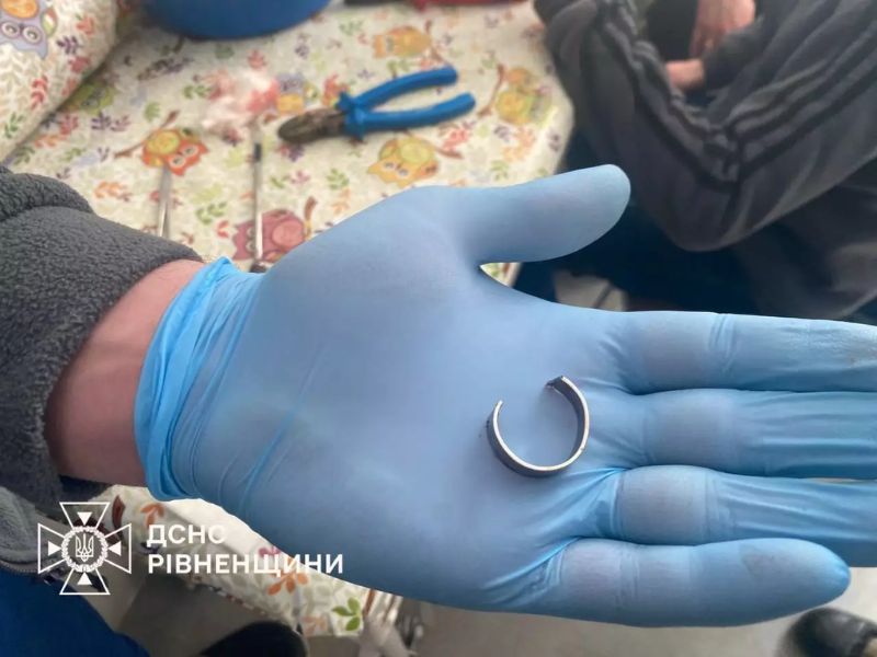 Разрезанное металлическое кольцо на ладони сотрудника ДСНС после оказания помощи подростку в Ровенской области.