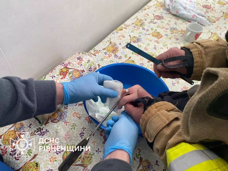 Специалисты ДСНС проводят техническую операцию по безопасному разрезанию металлического кольца на пальце пациента.
