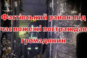 Фастівський район: під час пожежі постраждав громадянин
