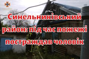 Синельниковский район: во время пожара пострадал мужчина