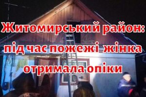Житомирський район: під час пожежі 93-річна жінка отримала опіки